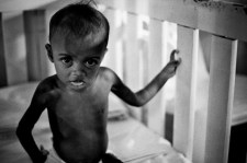 Fortaleza, Ceara, Brazil. In Brazil 41% of the children between 6 and 24 months are malnourished, consequences of the chronic malnutrition many children suffer cerebral damage. The problem of malnutrition in infants is more severe in the state of Pernambuco. IPREDE is a NGO with 24 years of work against the childlike malnutrition in the Regions of the Northeast of Brazil.